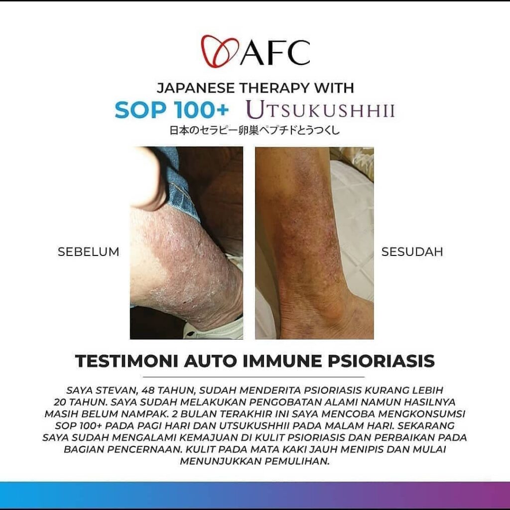 Jual SOP100+ Resmi BPOM Minuman Sereal Sehat Asli 13