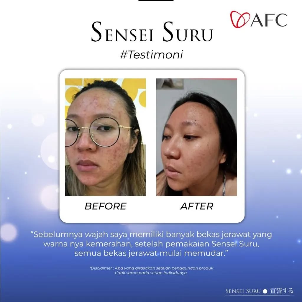 Jual Sensei Suru Serum Resmi BPOM Asli Original 2