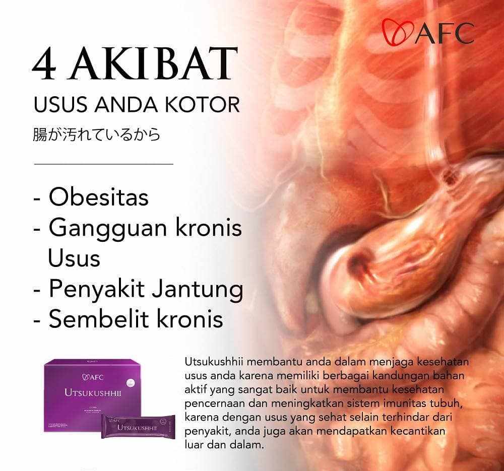 Jual Utsukushhii Gold Resmi – Imun & Kulit Sehat 12