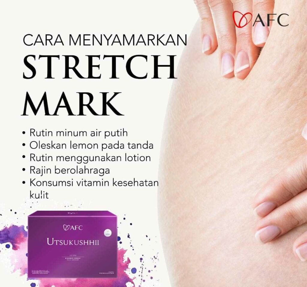 Jual Utsukushhii Gold Resmi – Imun & Kulit Sehat 22