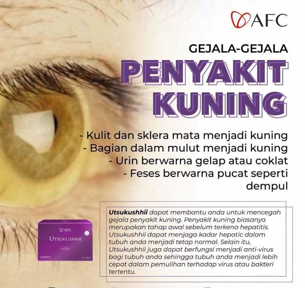 Jual Utsukushhii Gold Resmi – Imun & Kulit Sehat 29