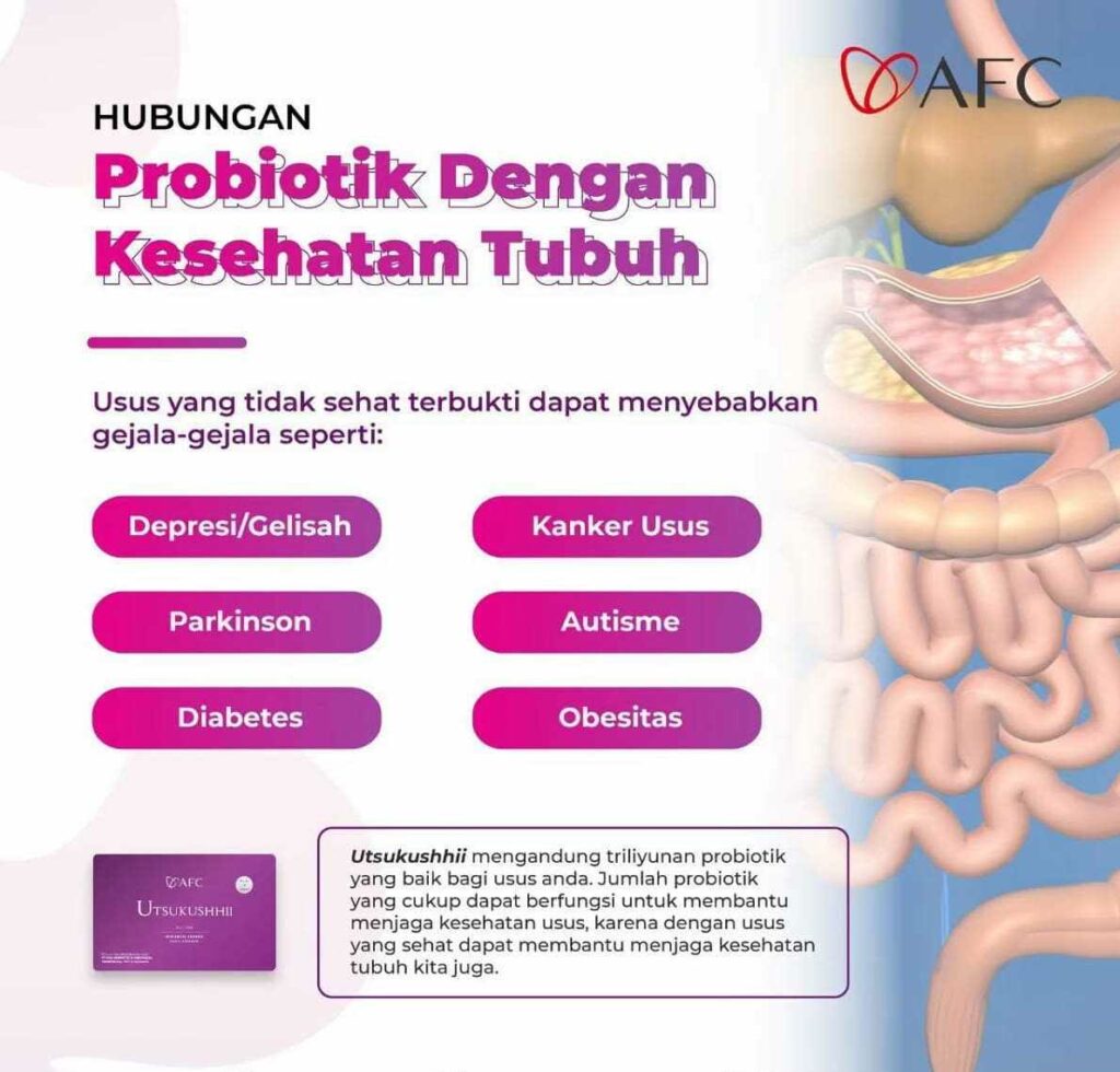 Jual Utsukushhii Gold Resmi – Imun & Kulit Sehat 33